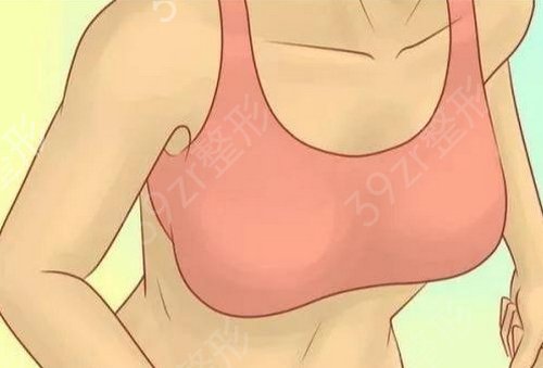 自体脂肪隆胸会吸收完吗？能终身保持吗？
