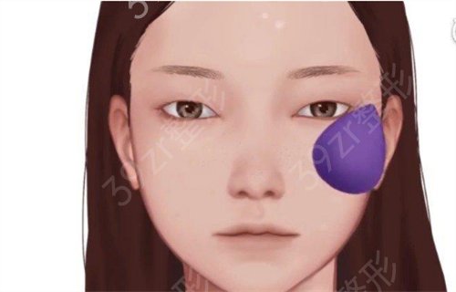 新疆医科大学*第一附属医院整形科双眼皮