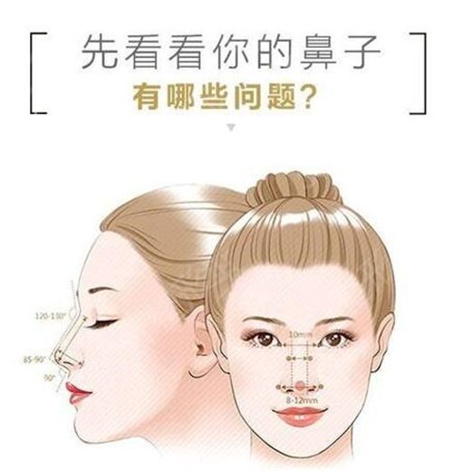 湘潭春天医疗美容价格表均价一览附隆鼻手术恢复过程图