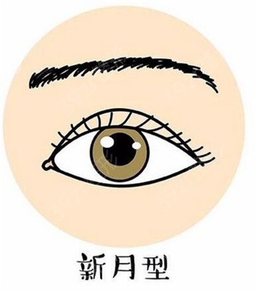 北京艺星医疗美容双眼皮案例