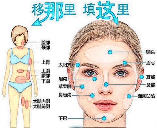 江西省人民医院整形美容科价格表和自体脂肪面部填充*果展示