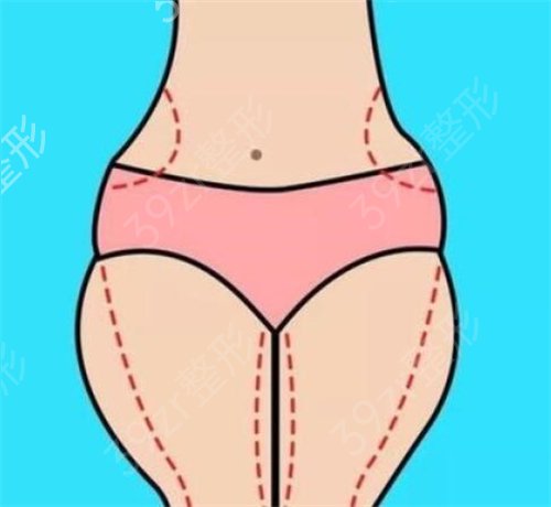 山东省立医院整形科大腿吸脂