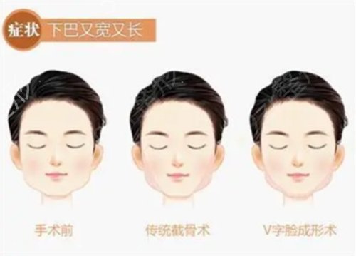 北京美联臣美容整形脸部轮廓