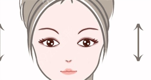 郑大二院整形外科杨丽眼修复案例以及术后*果图分享