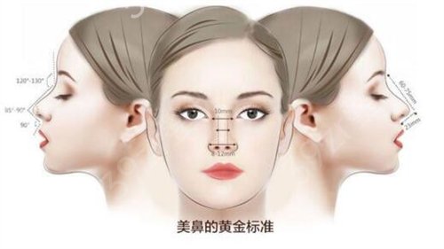 广州海峡军做鼻子好不好?一览医生成功隆鼻案例展示