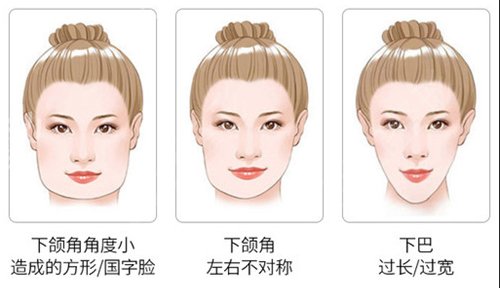 北京滕利磨骨怎么样?好吗?附磨骨真人案例一览