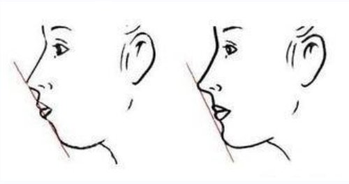 北京滕利磨骨怎么样?好吗?附磨骨真人案例一览