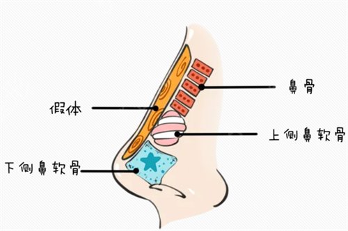 巫文云简介和鼻修复案例一览，还有术后三个月真实*果图分享