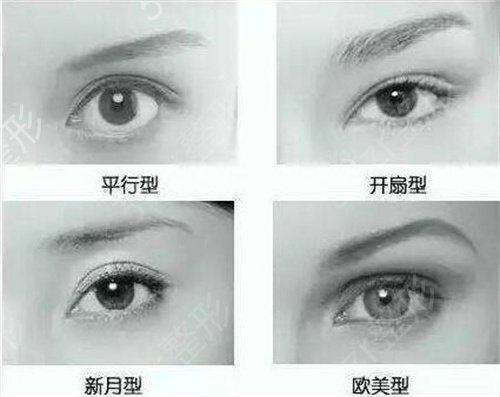 上海长征医院整形外科价格表一览，双眼皮整形日记曝光