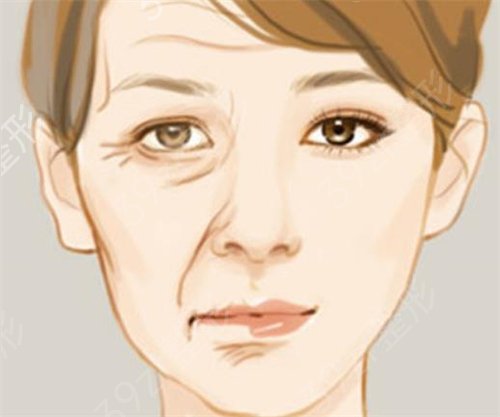 快速消除脸部细纹应该怎么做？使用哪些护肤品？