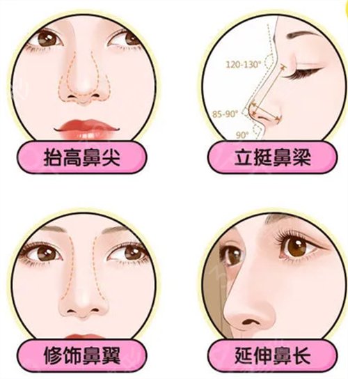 【科普篇】肋软骨隆鼻优势分析_用途展示