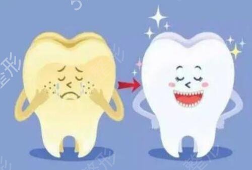牙齿冷光美白可以维持多久？术后有哪些需要注意？