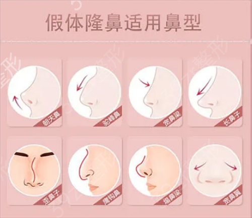 上海美立方医院周光杰做的鼻子怎么样？自然款隆鼻真人*果图分享一览