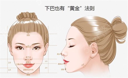 下巴后缩如何改良，不同情况适合不同的手术方式