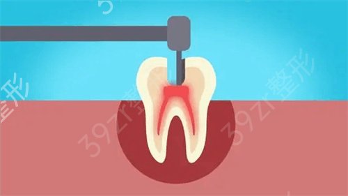 天津市中医院口腔科牙齿修复案例