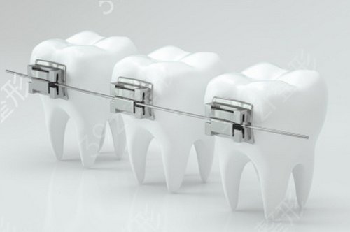 苏州牙博士口腔医院价格表劲爆价发布，附牙齿矫正案例