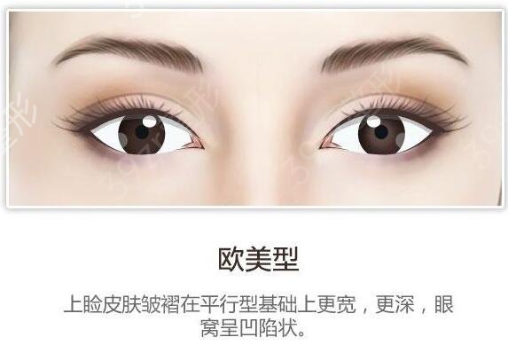 上海双眼皮医生强，技术和审美双双在线！