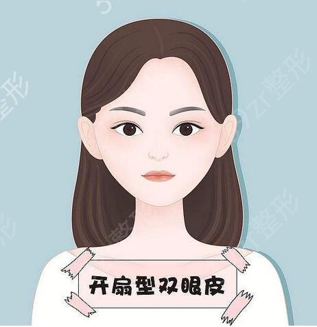 上海眼王柴云案例：眼睛(双眼皮)做的怎么样|图片|人气医生费用曝光
