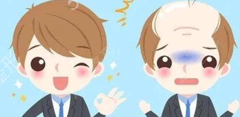 【】全国植发医生介绍甲，坐诊医院揭晓！