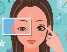 不同方式割双眼皮有什么优缺点？