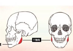 磨颧骨手术风险大吗？需要多少钱？手术过程这里讲清楚了