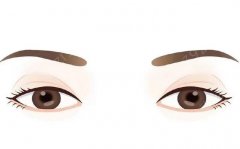 双眼皮遗传规律一览，眼皮一单一双纠正大法揭晓