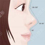微创隆鼻手术要花多少钱？
