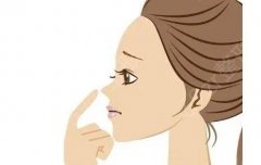 自体脂肪填充鼻唇沟有效吗，有哪些优点
