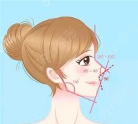 膨体隆鼻手术有哪些优点？