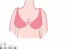 乳晕缩小手术效果如何？会影响乳房吗