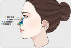 隆鼻修复过程中需要注意哪些方面