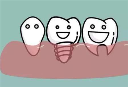 种植牙能进医保吗？医保对于种植牙的报销标准是什么？