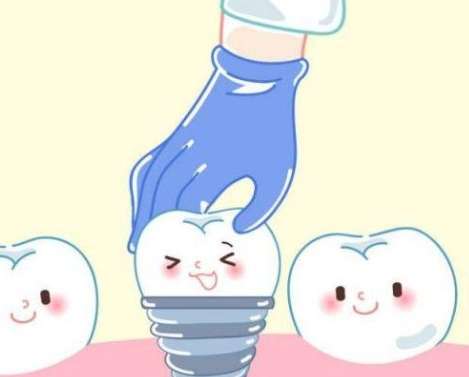 种植牙哪个步骤痛苦？分享种植牙的整个过程