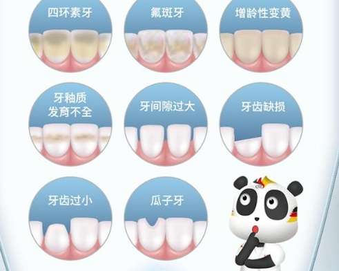 牙缝大了怎么处理方法？就为大家介绍几种常见的方法。