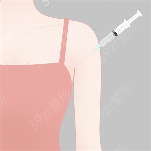 上海市胸科医院整形科乳房下垂矫正案例果图，内附整形